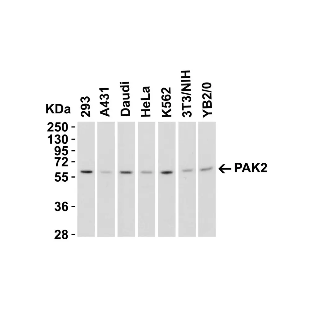 ProSci 3885 PAK2 Antibody, ProSci, 0.1 mg/Unit Tertiary Image