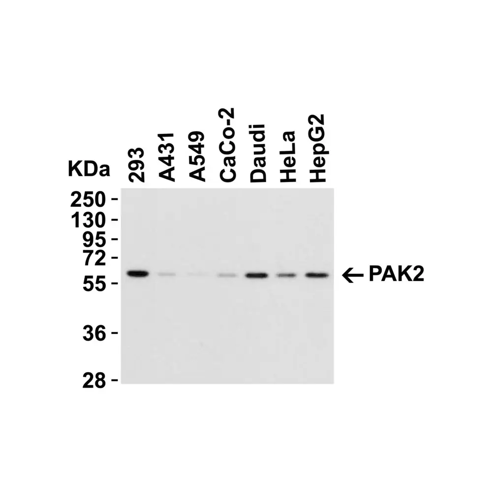 ProSci 3887 PAK2 Antibody, ProSci, 0.1 mg/Unit Tertiary Image