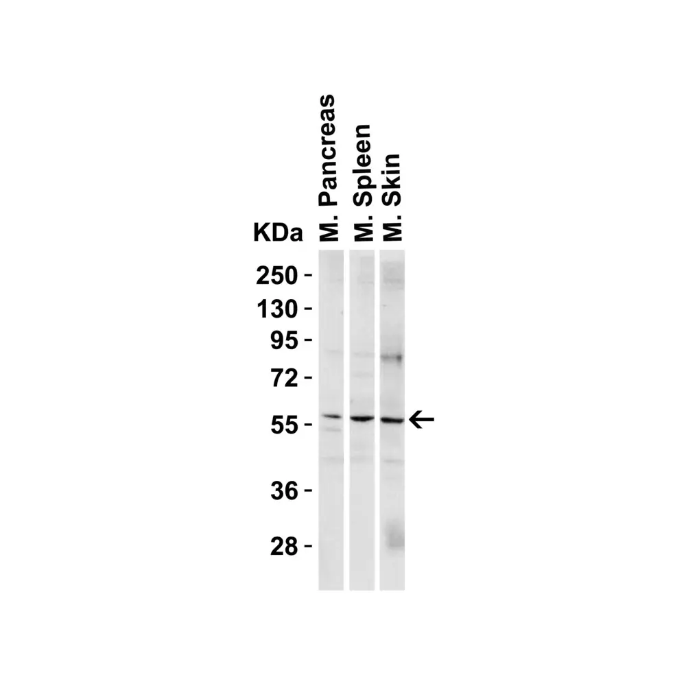 ProSci 3887_S PAK2 Antibody, ProSci, 0.02 mg/Unit Quaternary Image