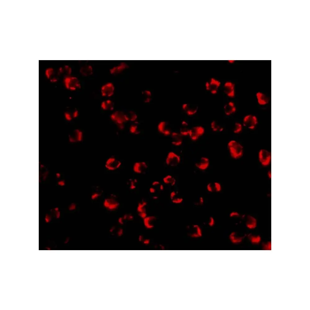 ProSci 3075 PAK5 Antibody, ProSci, 0.1 mg/Unit Tertiary Image