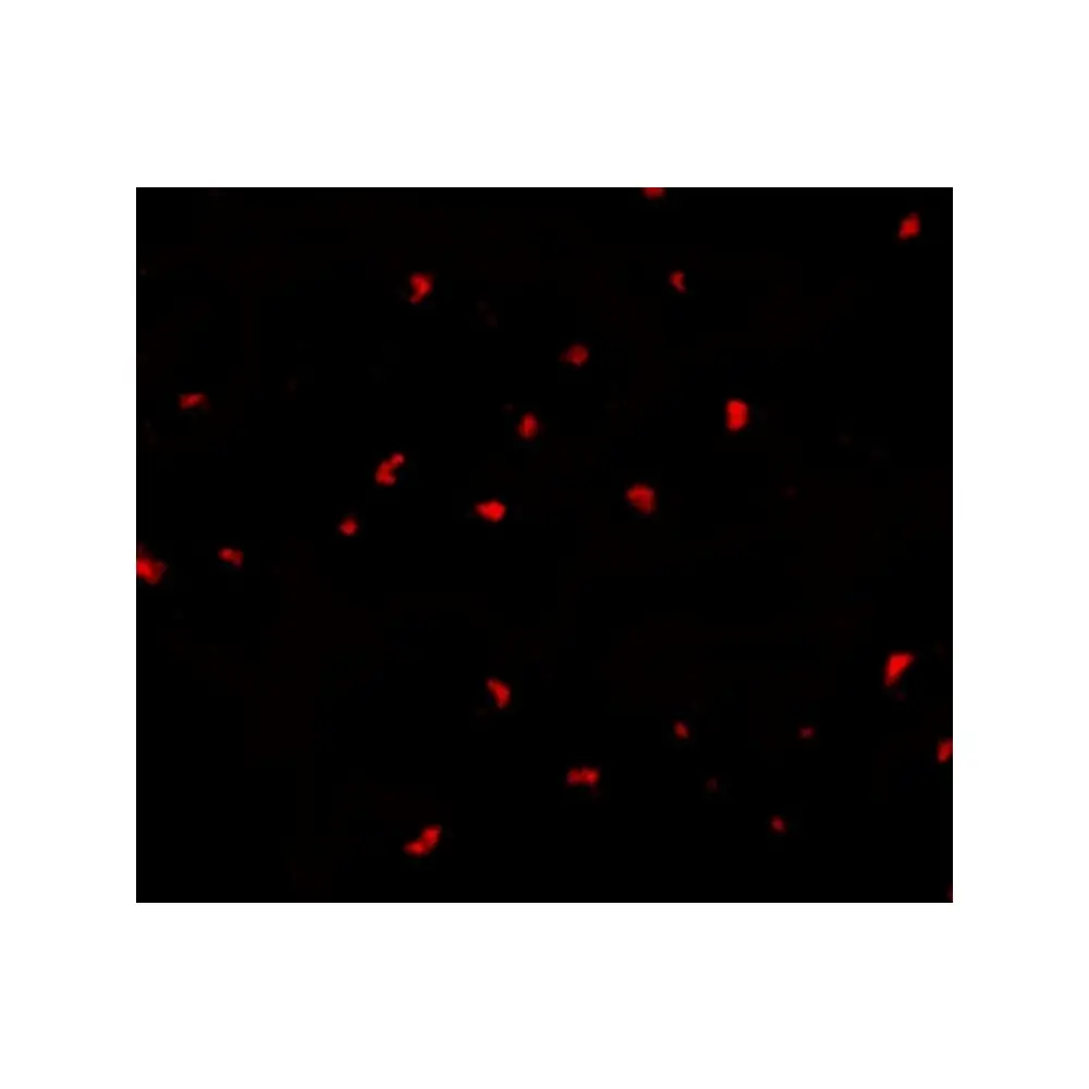 ProSci 3073_S PAK6 Antibody, ProSci, 0.02 mg/Unit Tertiary Image