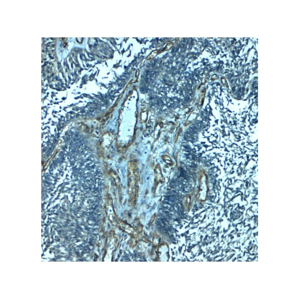 ProSci 8237 PALMD Antibody, ProSci, 0.1 mg/Unit Secondary Image
