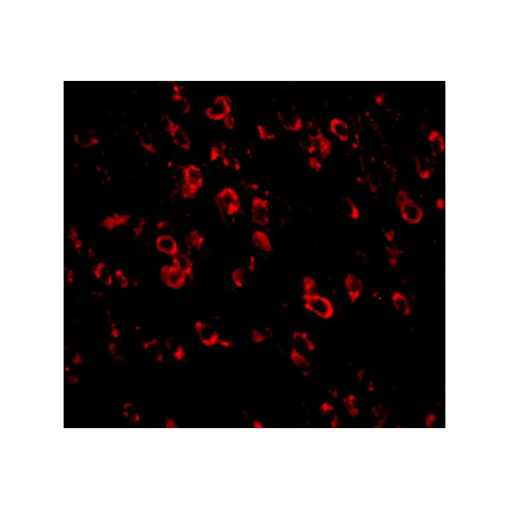 ProSci 5081 PCDH18 Antibody, ProSci, 0.1 mg/Unit Tertiary Image