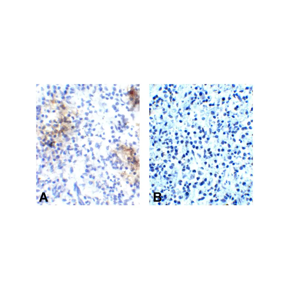 ProSci RF16005_S PD1 Antibody [10B3], ProSci, 0.02 mg/Unit Secondary Image