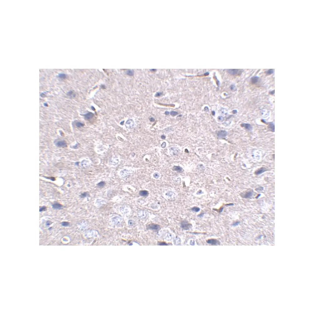 ProSci PM-5179 PD-1 Antibody [12A7D7] , ProSci, 0.1 mg/Unit Secondary Image