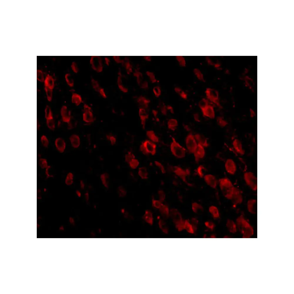 ProSci PM-5177 PD-1 Antibody [7A11B1] , ProSci, 0.1 mg/Unit Tertiary Image