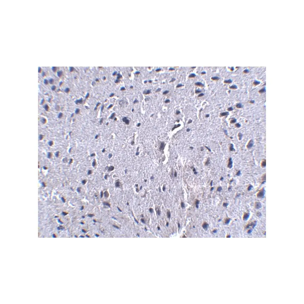ProSci PM-5177 PD-1 Antibody [7A11B1] , ProSci, 0.1 mg/Unit Secondary Image