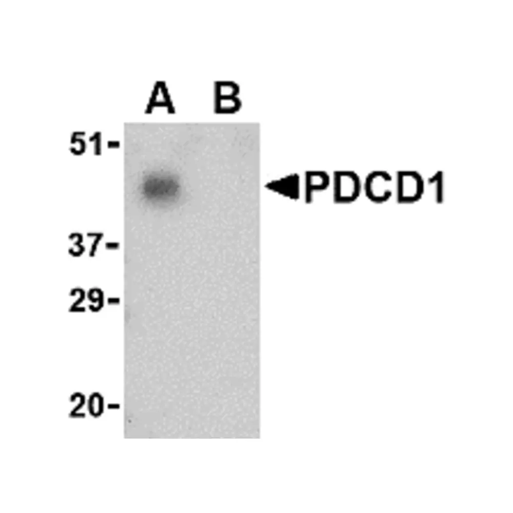 ProSci 4065_S PD-1 Antibody, ProSci, 0.02 mg/Unit Quaternary Image