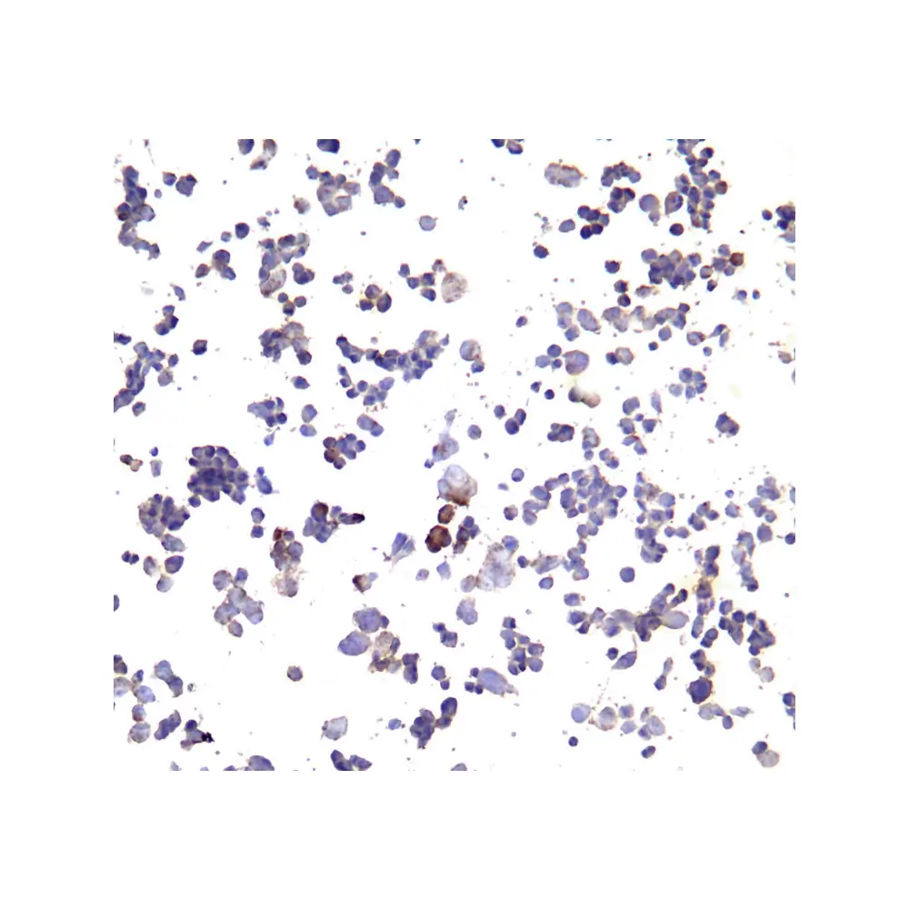 ProSci SD8641 PD-L1 Single Domain Antibody [F2G2], ProSci, 0.1 mg/Unit Tertiary Image