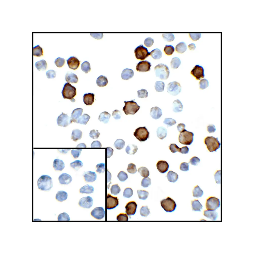 ProSci RF16022 PDL2 Antibody [8C12], ProSci, 0.1 mg/Unit Secondary Image