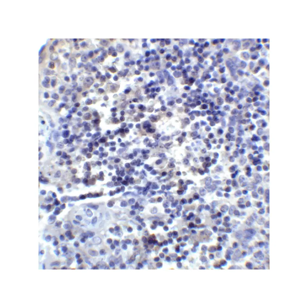 ProSci RF16022 PDL2 Antibody [8C12], ProSci, 0.1 mg/Unit Senary Image