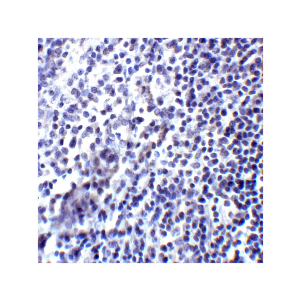 ProSci RF16025 PDL2 Antibody [10H6], ProSci, 0.1 mg/Unit Senary Image