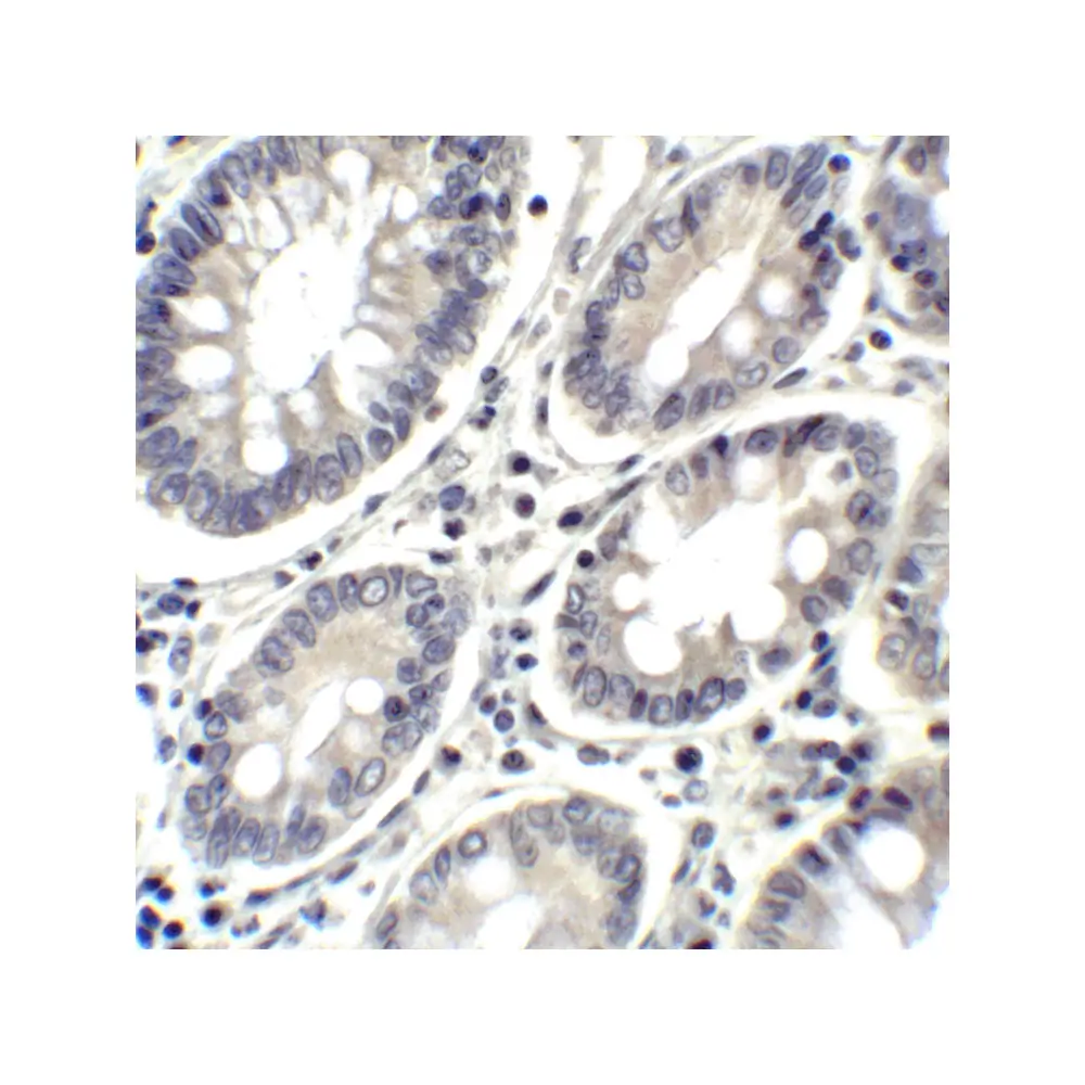 ProSci RF16024_S PDL2 Antibody [7C1], ProSci, 0.02 mg/Unit Senary Image
