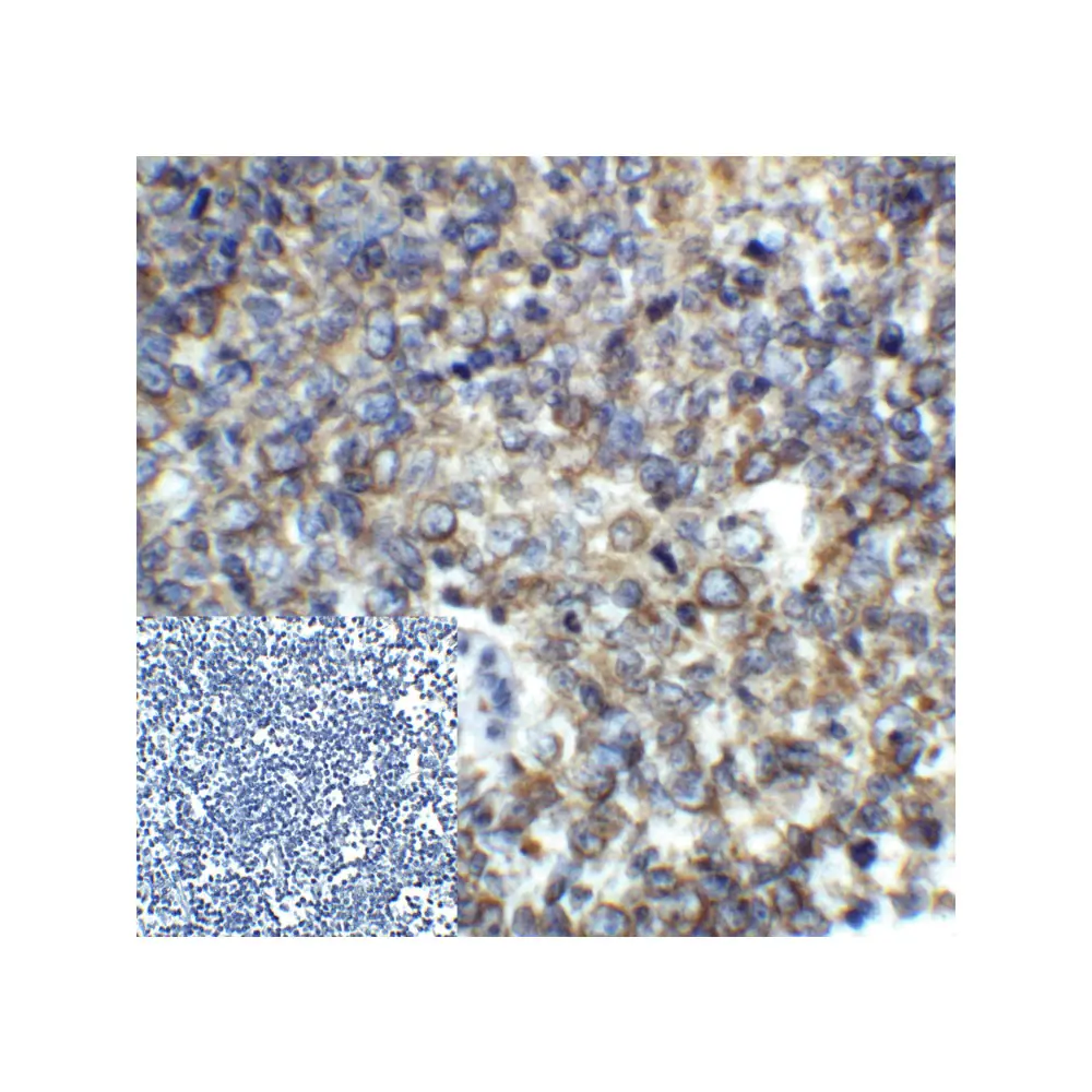 ProSci RF16006 PD1 Antibody [5D3], ProSci, 0.1 mg/Unit Quaternary Image