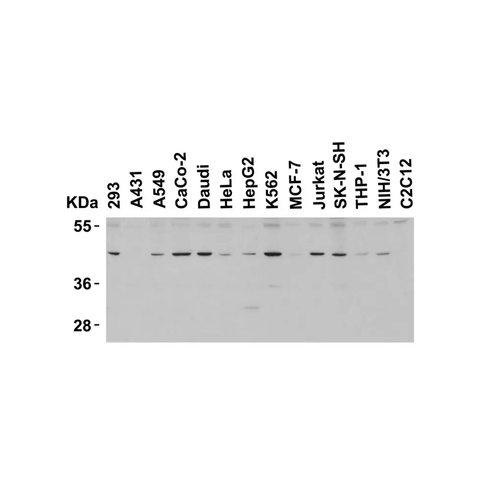 ProSci 4065 PD-1 Antibody, ProSci, 0.1 mg/Unit Tertiary Image