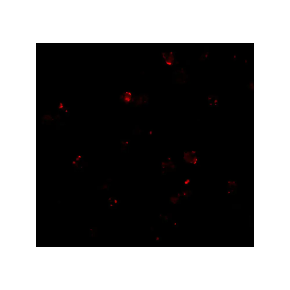 ProSci 3979 PEN2 Antibody, ProSci, 0.1 mg/Unit Secondary Image