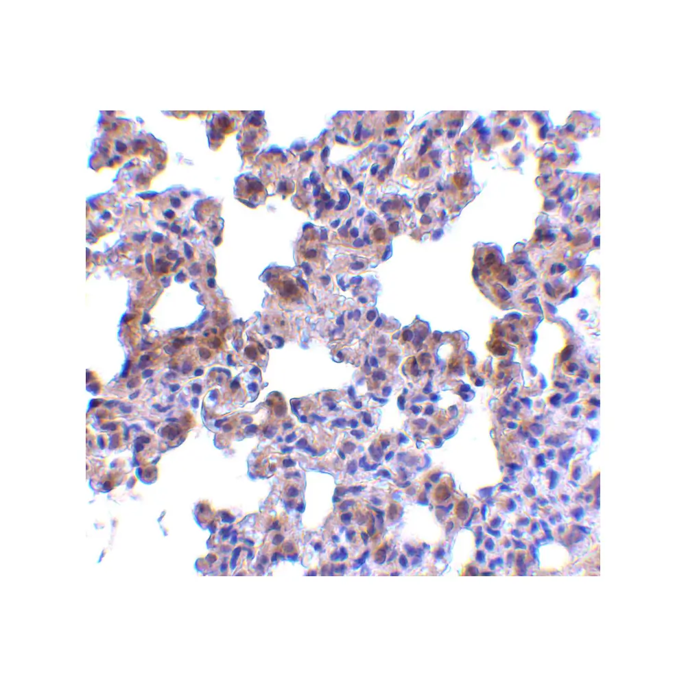 ProSci 3981_S PEN2 Antibody, ProSci, 0.02 mg/Unit Secondary Image