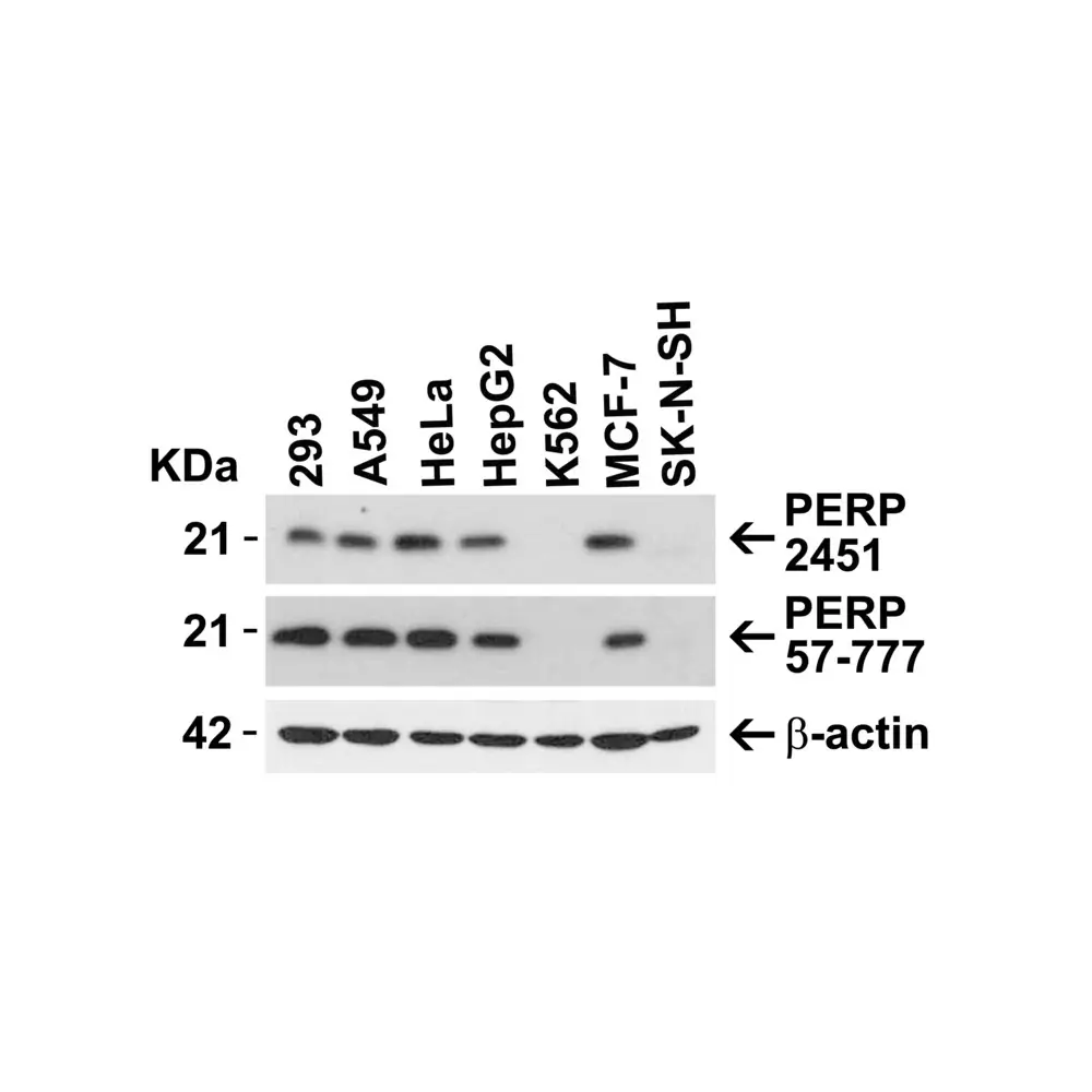 ProSci 2451_S PERP Antibody, ProSci, 0.02 mg/Unit Primary Image