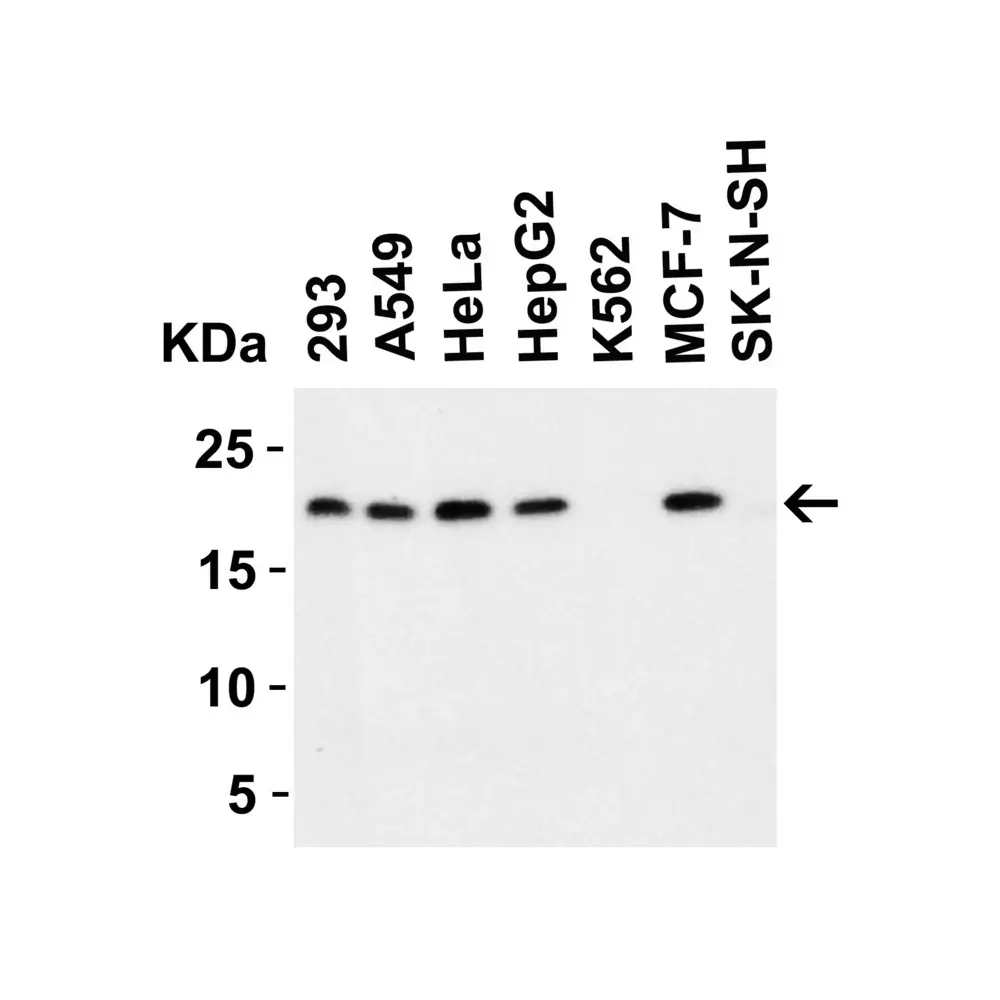ProSci 2451 PERP Antibody, ProSci, 0.1 mg/Unit Secondary Image