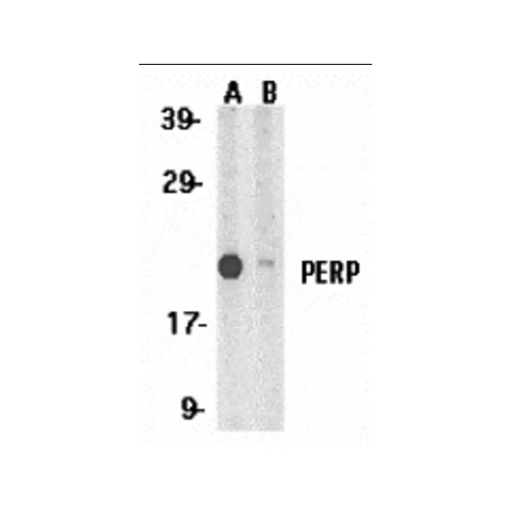 ProSci 2451 PERP Antibody, ProSci, 0.1 mg/Unit Tertiary Image