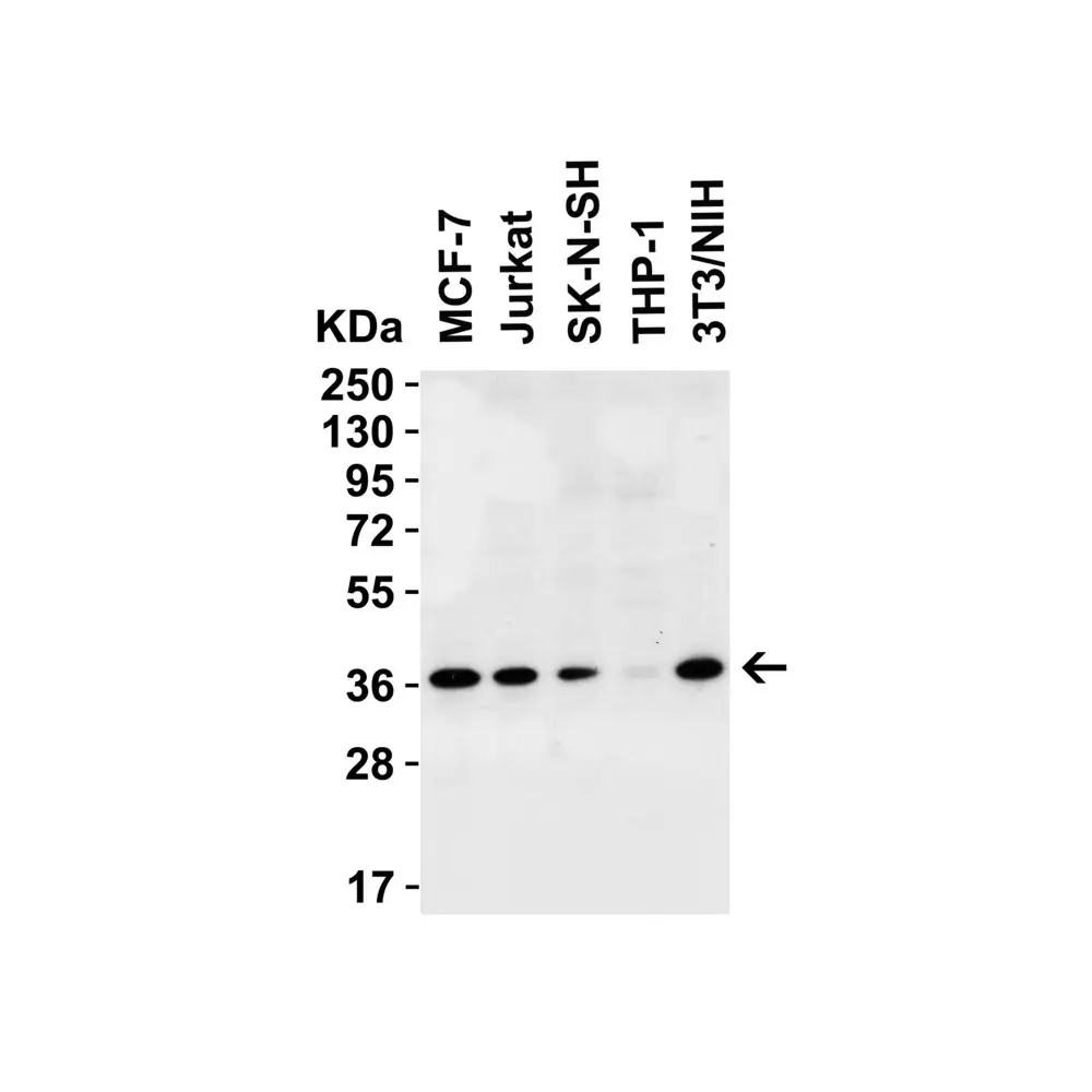 ProSci 9671 PEX10 (CT) Antibody, ProSci, 0.1 mg/Unit Primary Image