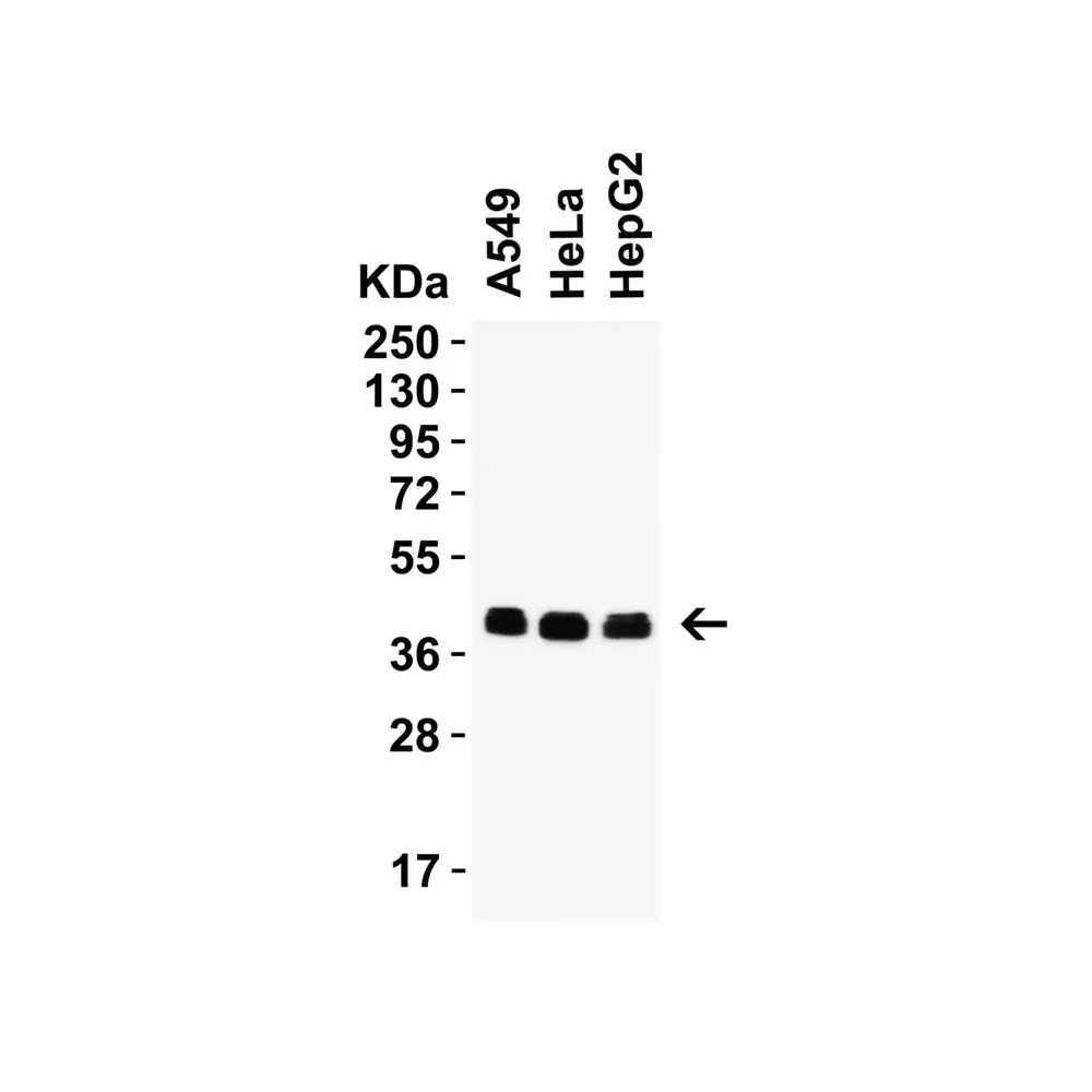ProSci 9667_S PEX3 (IN) Antibody, ProSci, 0.02 mg/Unit Primary Image