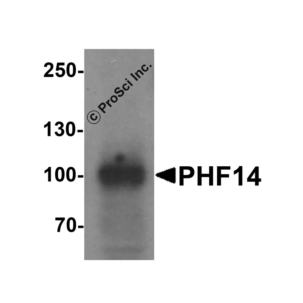 ProSci 7485 PHF14 Antibody , ProSci, 0.1 mg/Unit Secondary Image