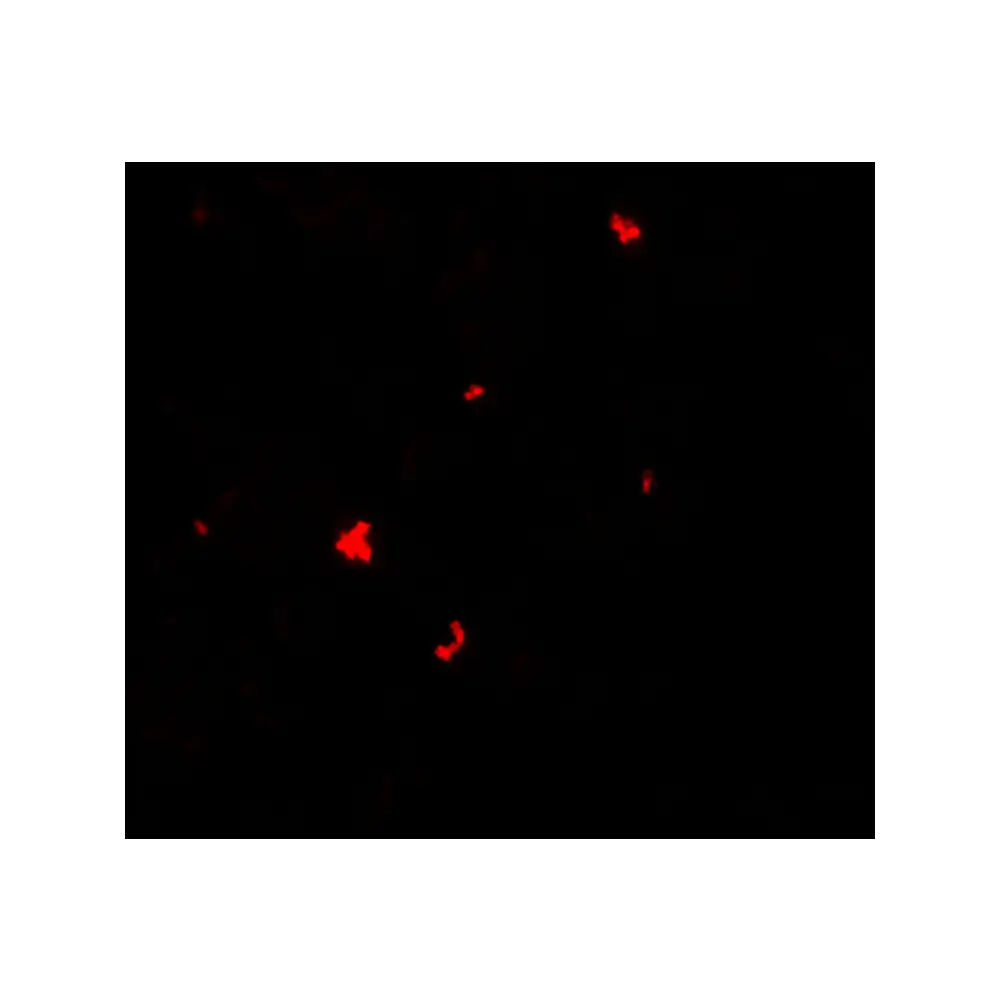 ProSci 7019_S PHLPP1 Antibody, ProSci, 0.02 mg/Unit Tertiary Image