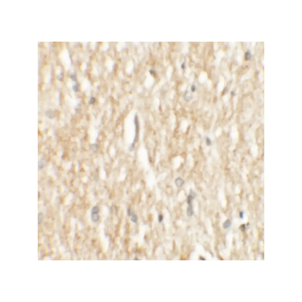 ProSci 6827_S PHOX2A Antibody, ProSci, 0.02 mg/Unit Secondary Image