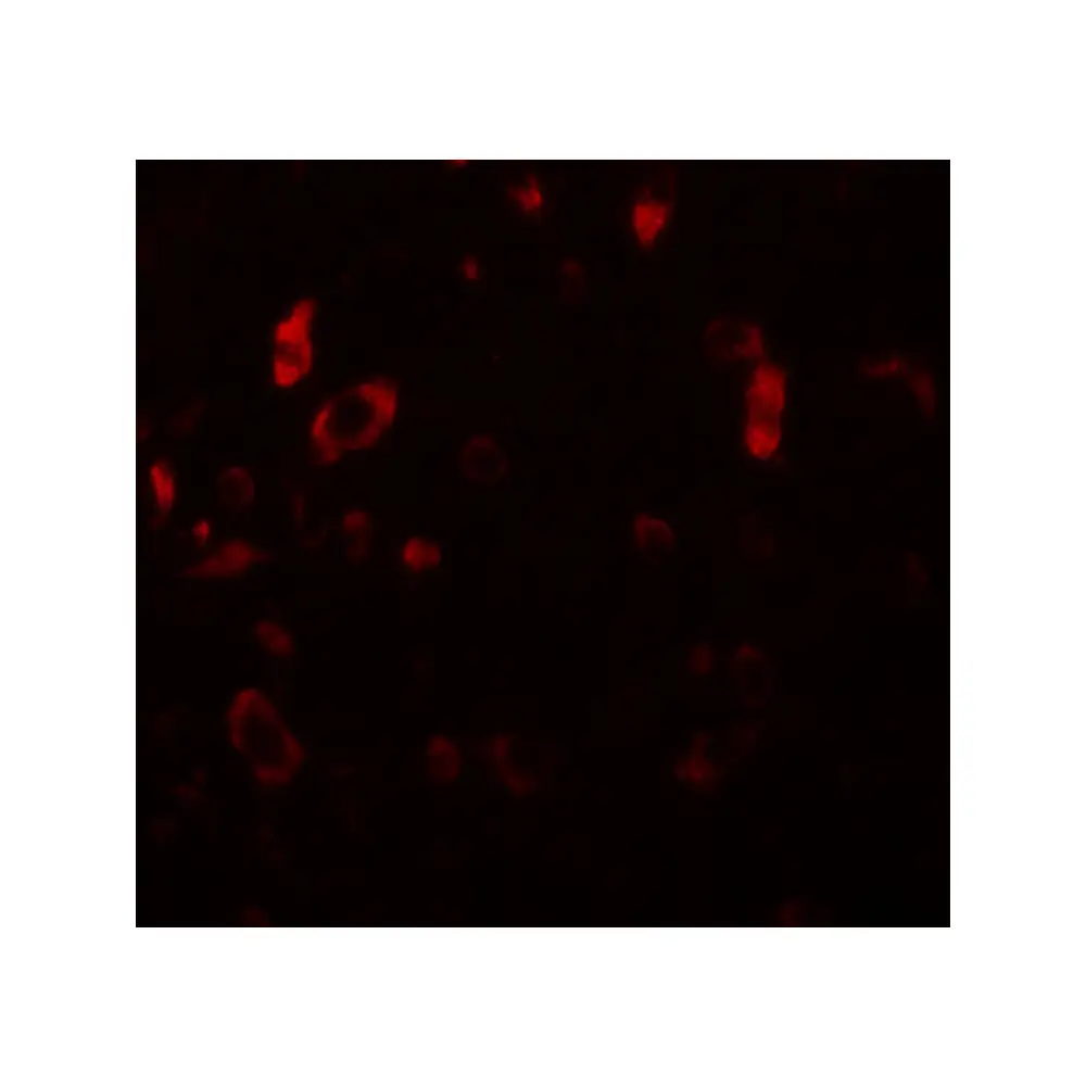 ProSci 5743 PIAS2 Antibody, ProSci, 0.1 mg/Unit Tertiary Image