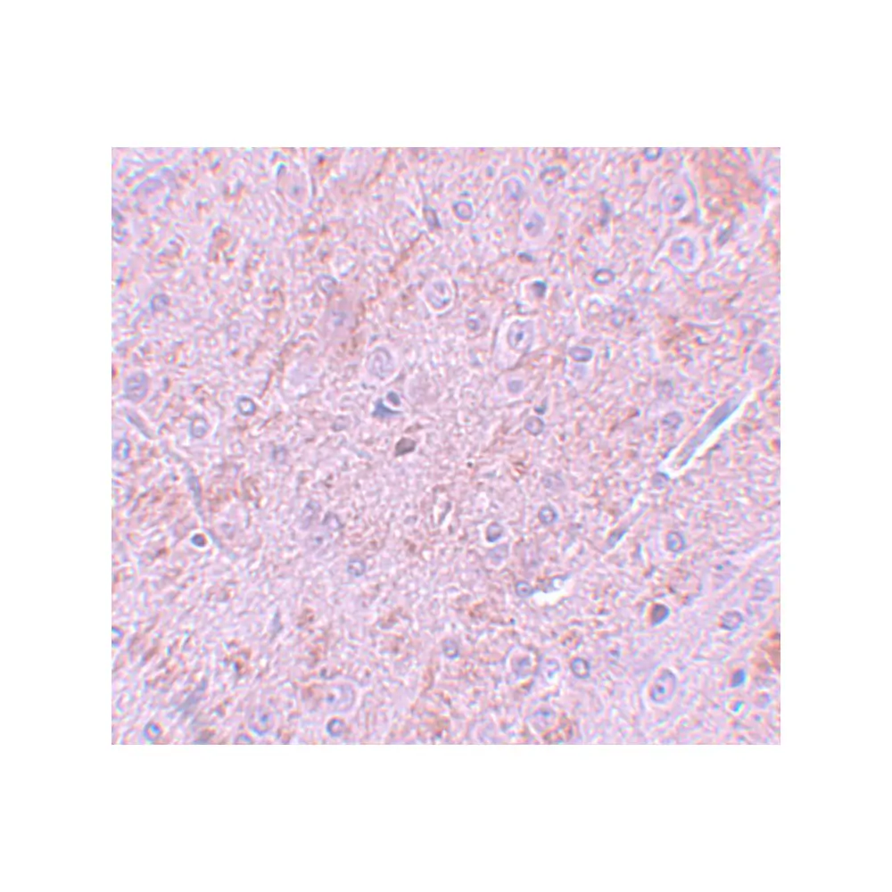 ProSci 5743 PIAS2 Antibody, ProSci, 0.1 mg/Unit Secondary Image