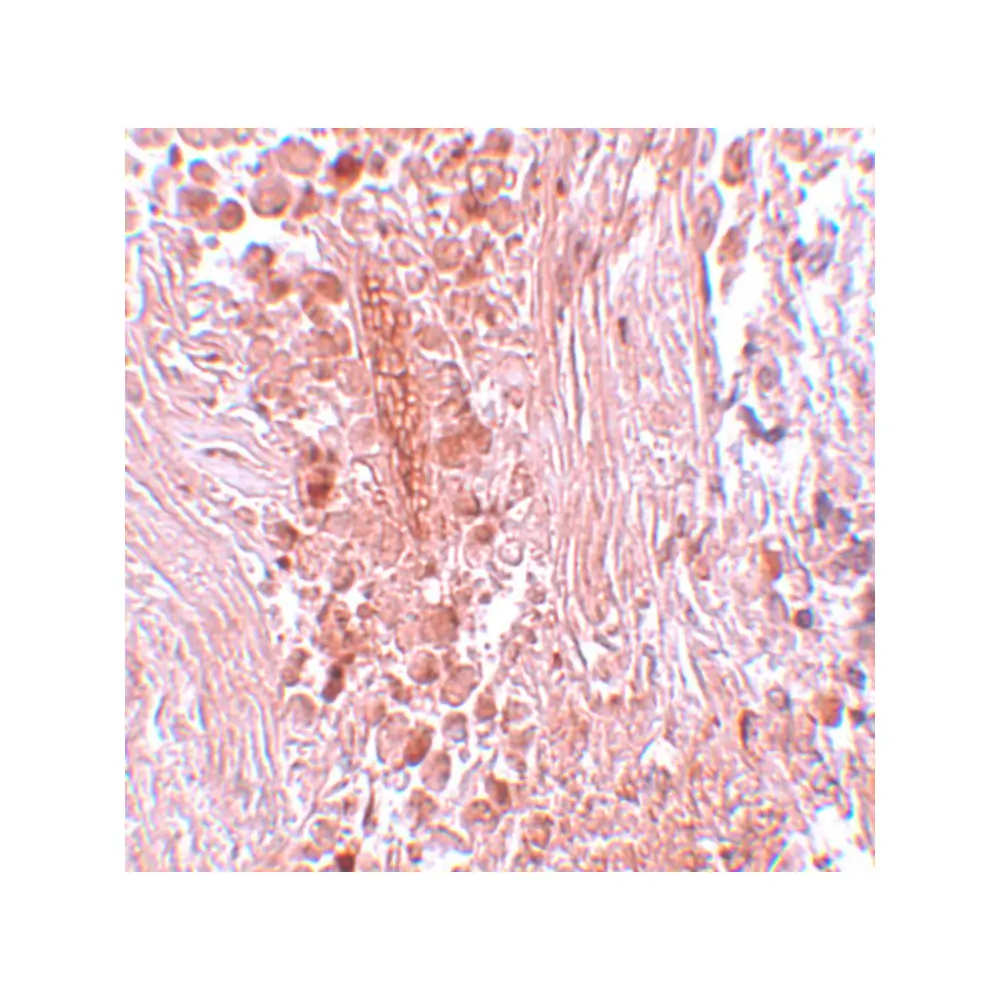ProSci 5745 PIAS3 Antibody, ProSci, 0.1 mg/Unit Secondary Image