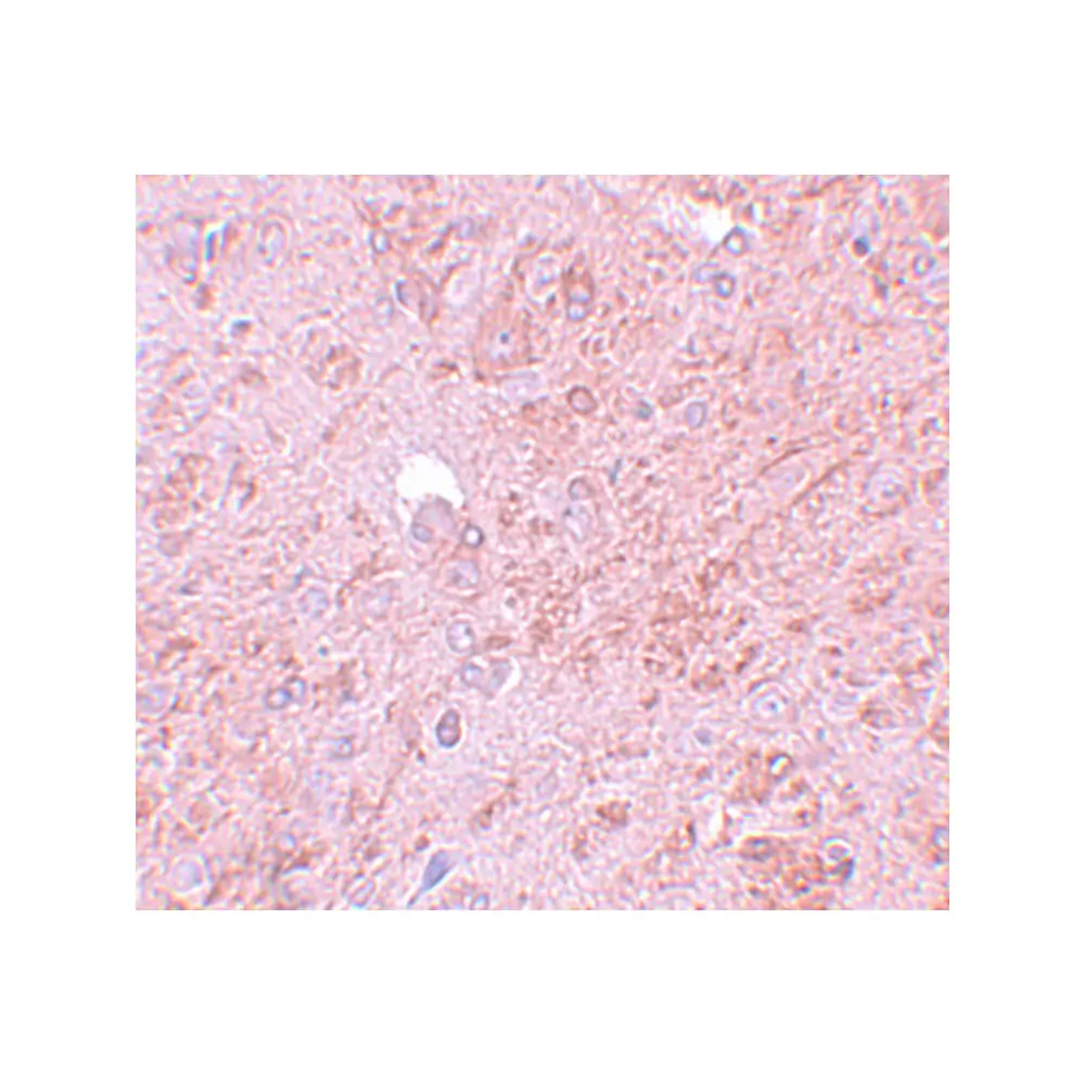 ProSci 5747_S PIAS4 Antibody, ProSci, 0.02 mg/Unit Secondary Image