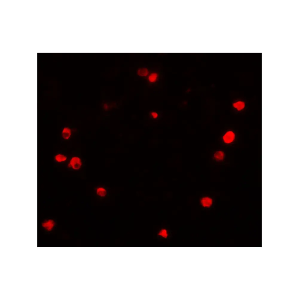 ProSci 7237 PIBF1 Antibody, ProSci, 0.1 mg/Unit Tertiary Image