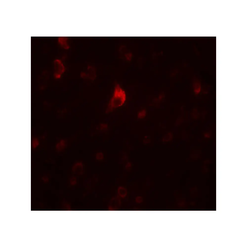 ProSci 5553_S PICALM Antibody, ProSci, 0.02 mg/Unit Secondary Image