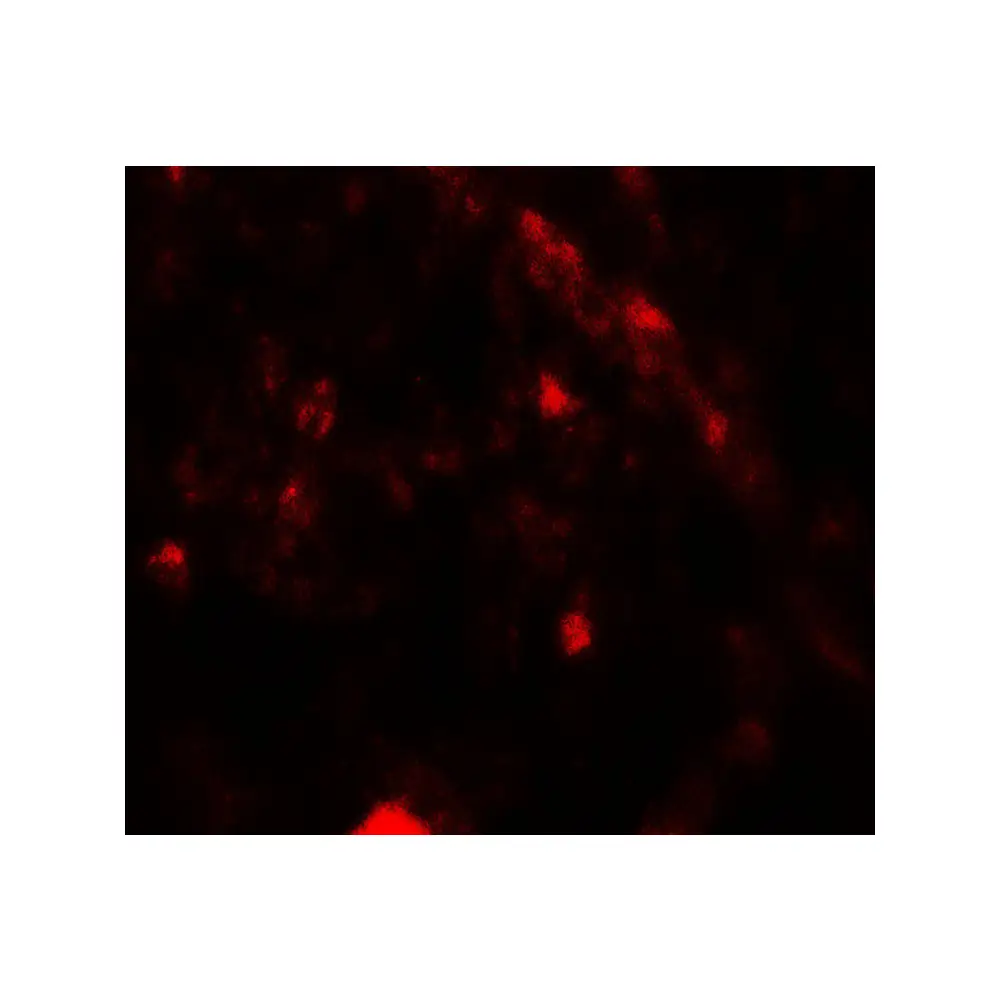 ProSci 7949_S PIK3R4 Antibody, ProSci, 0.02 mg/Unit Tertiary Image