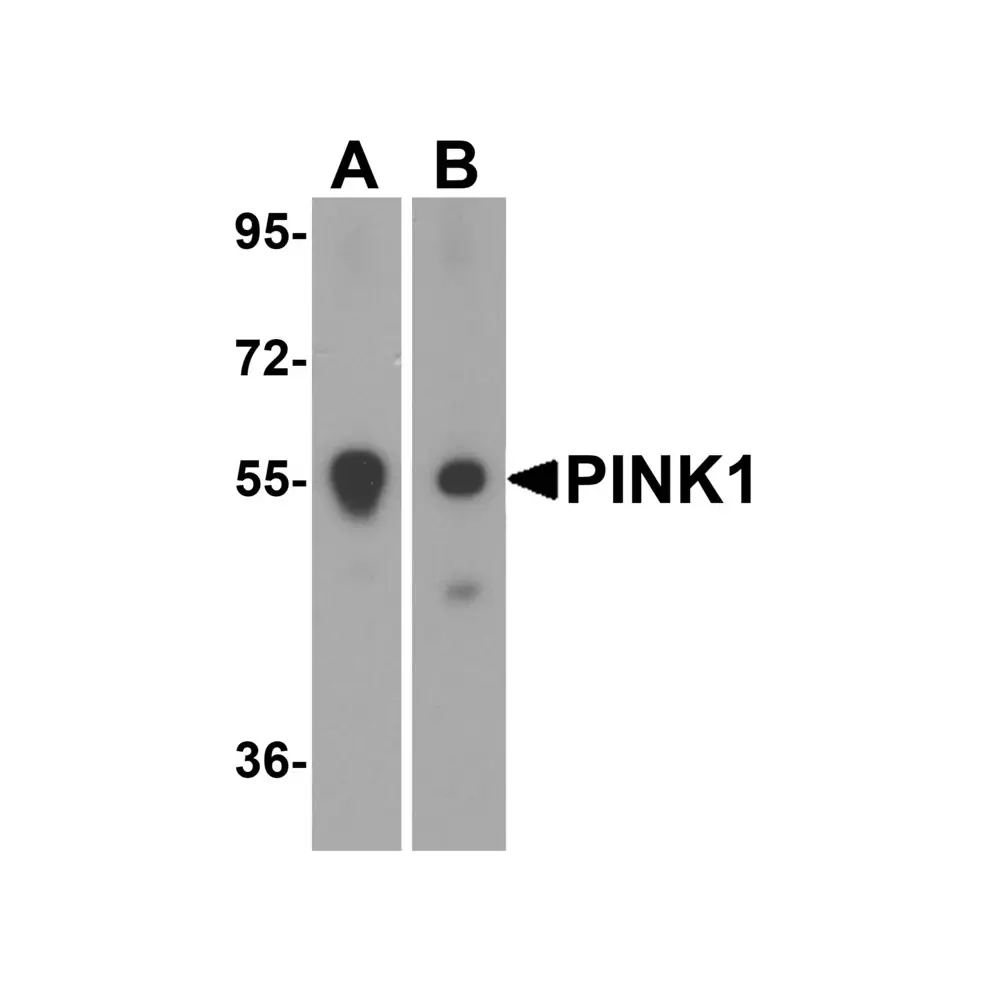 ProSci 7859_S PINK1 Antibody, ProSci, 0.02 mg/Unit Quaternary Image