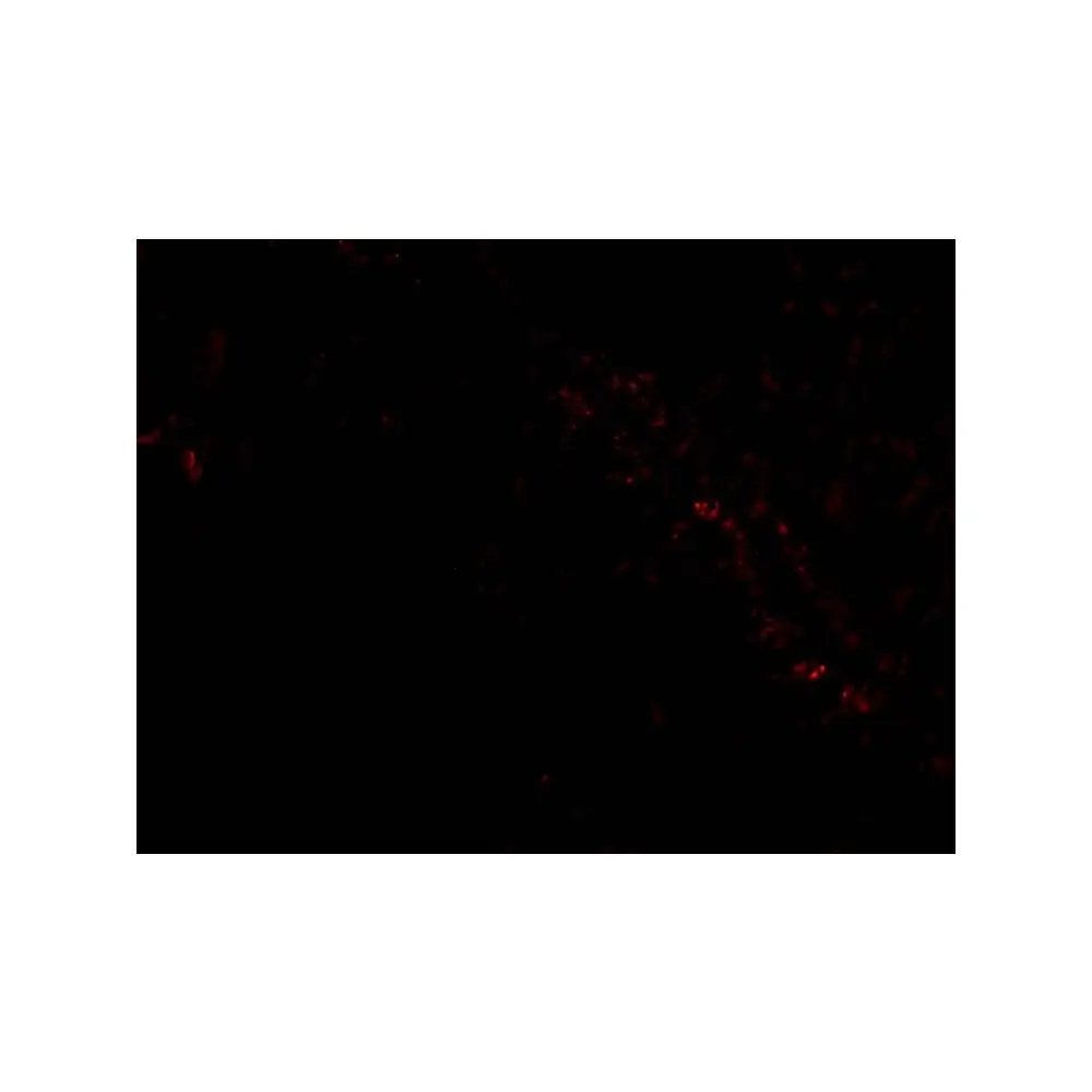 ProSci 3633_S PIST Antibody, ProSci, 0.02 mg/Unit Tertiary Image