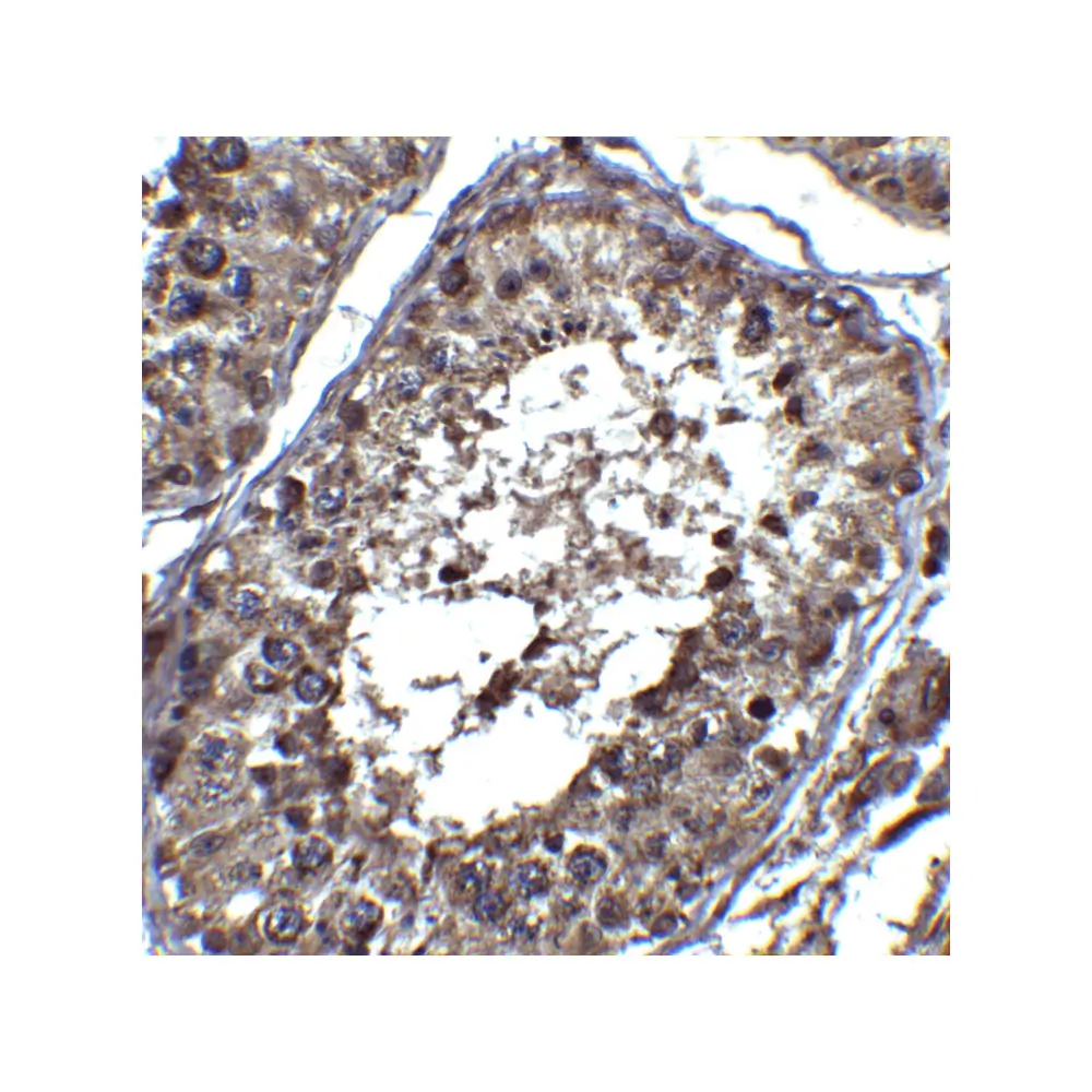 ProSci 3631 PIST Antibody, ProSci, 0.1 mg/Unit Quaternary Image