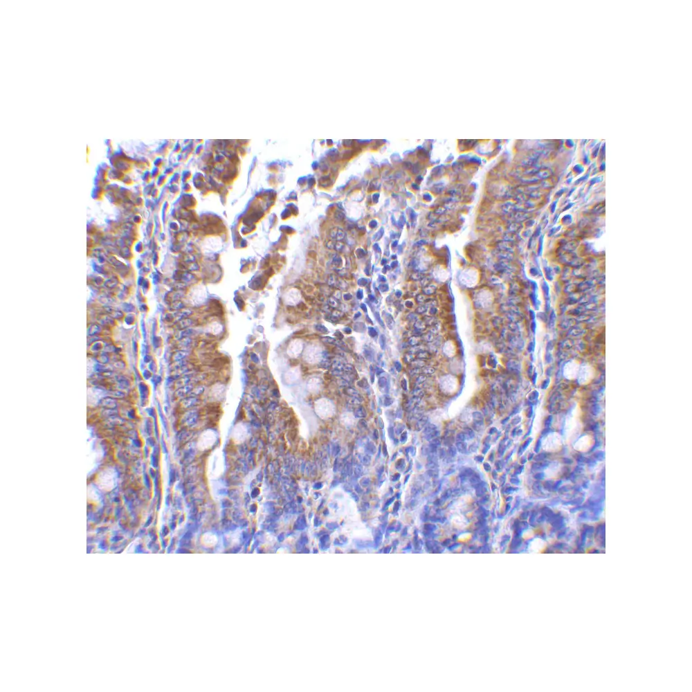 ProSci 3631_S PIST Antibody, ProSci, 0.02 mg/Unit Secondary Image