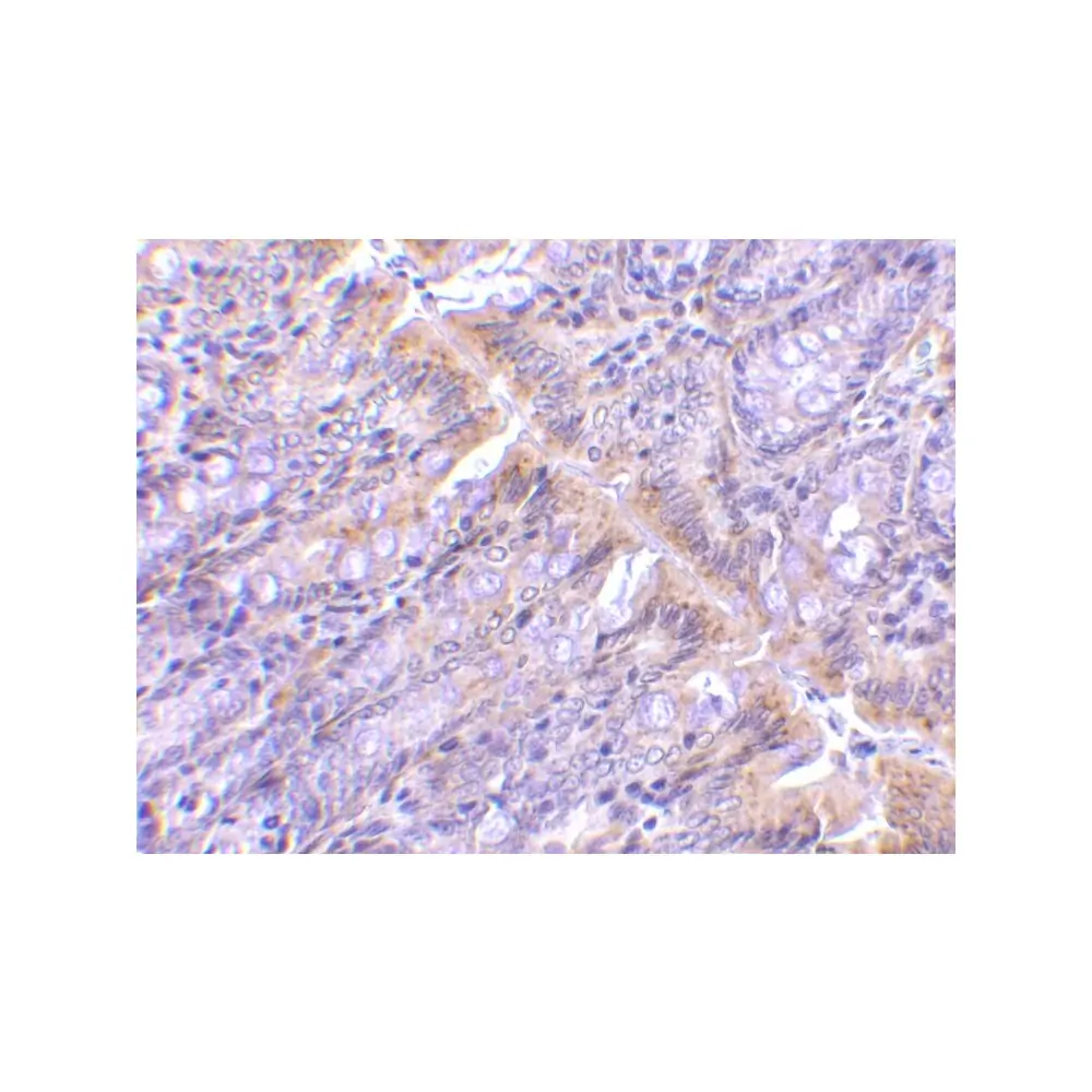 ProSci 3633_S PIST Antibody, ProSci, 0.02 mg/Unit Secondary Image