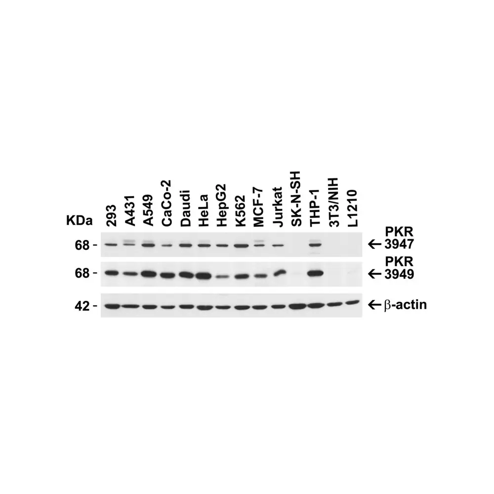 ProSci 3949 PKR Antibody, ProSci, 0.1 mg/Unit Secondary Image