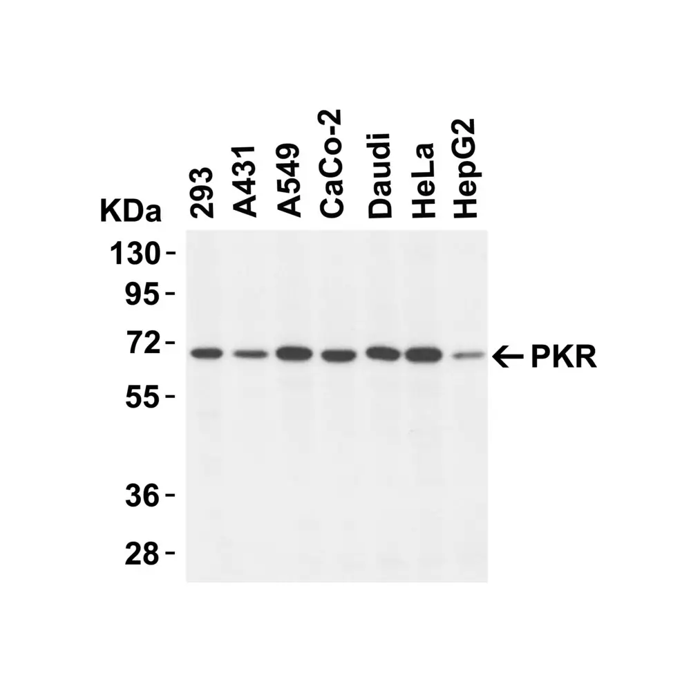 ProSci 3949 PKR Antibody, ProSci, 0.1 mg/Unit Tertiary Image
