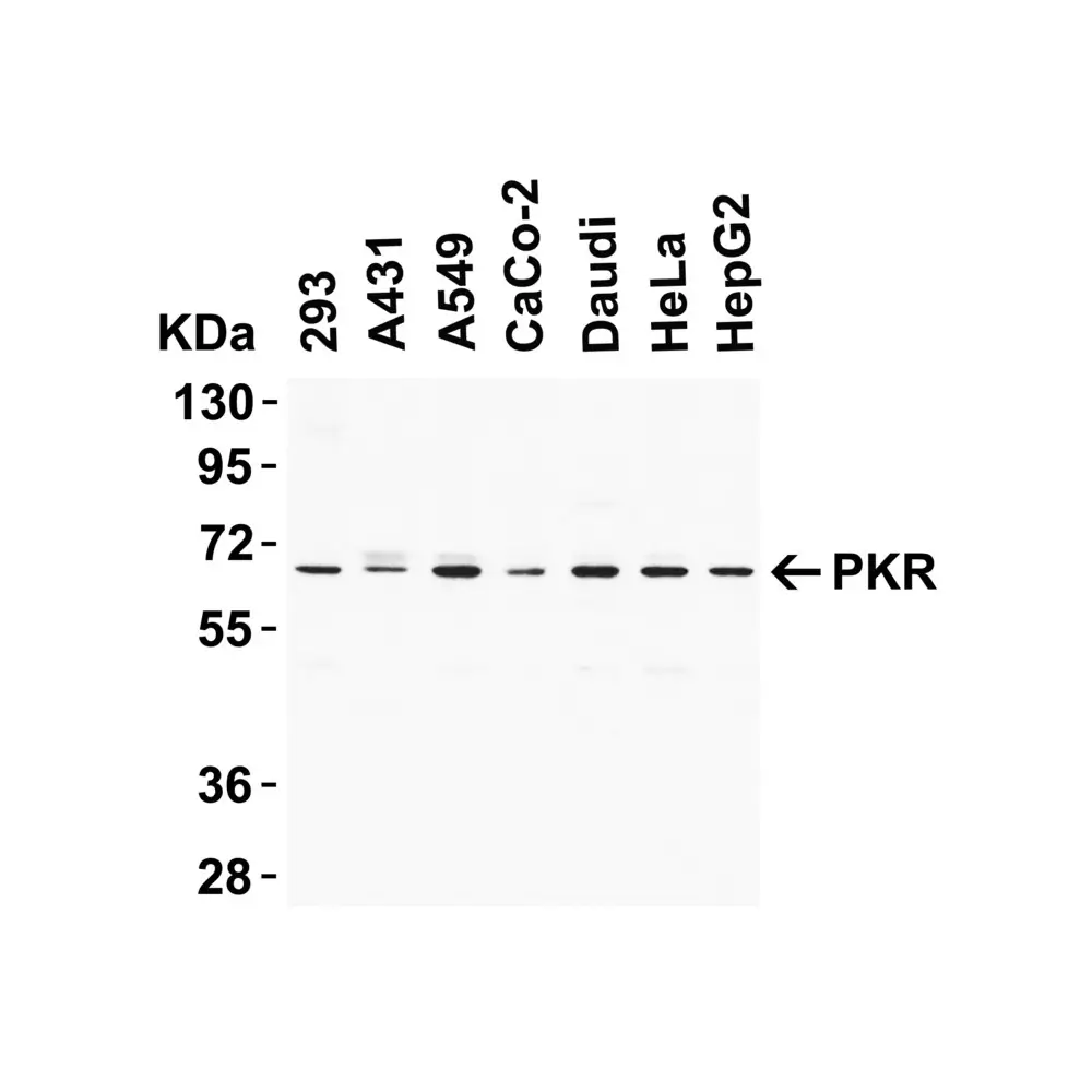 ProSci 3947_S PKR Antibody, ProSci, 0.02 mg/Unit Primary Image