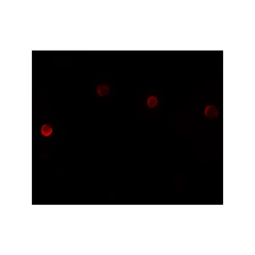 ProSci 6015_S PLAC1 Antibody, ProSci, 0.02 mg/Unit Tertiary Image