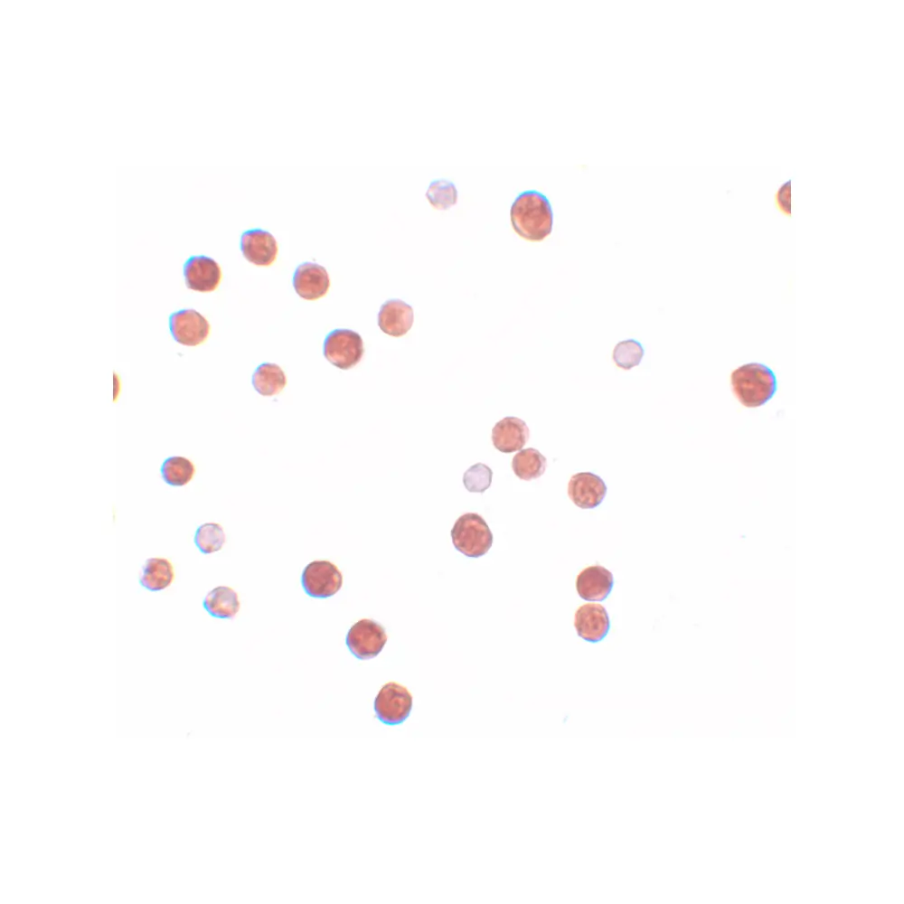 ProSci 6021 PLAC4 Antibody, ProSci, 0.1 mg/Unit Secondary Image
