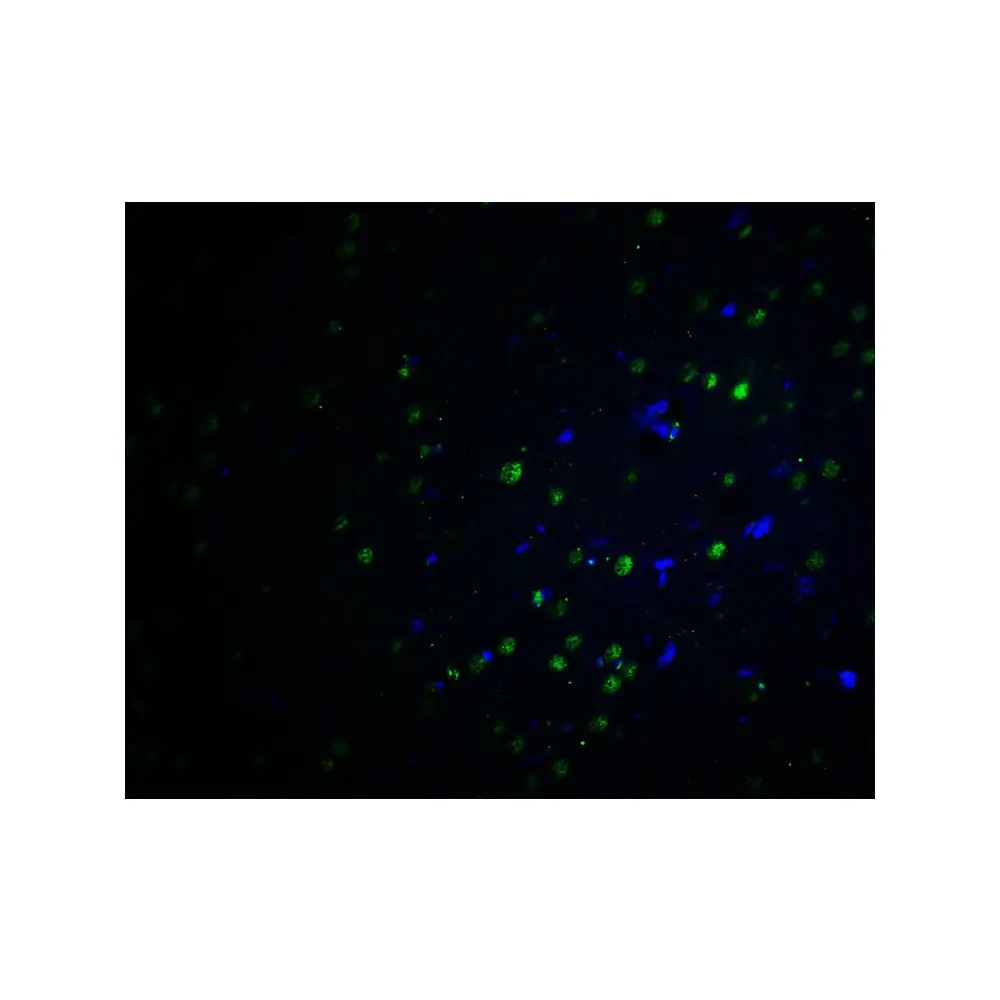 ProSci 7053 PLAGL2 Antibody, ProSci, 0.1 mg/Unit Tertiary Image