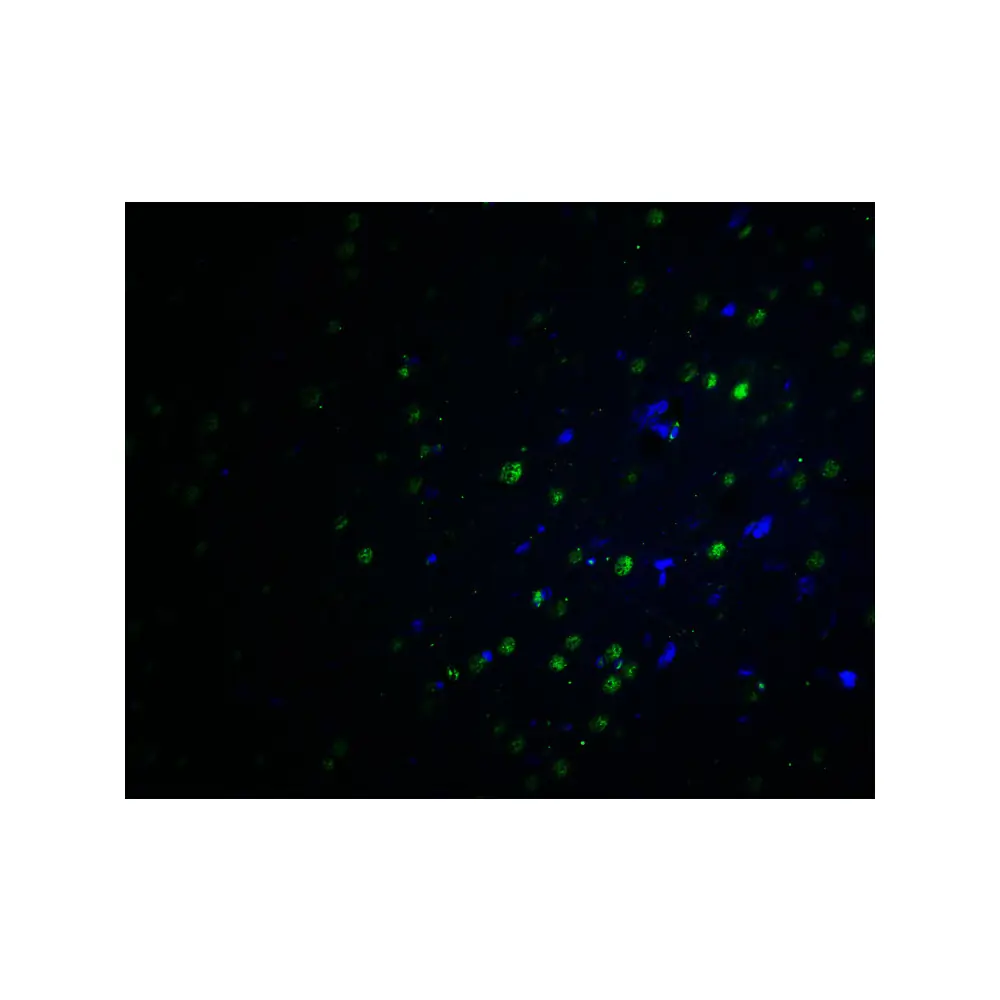 ProSci 7053_S PLAGL2 Antibody, ProSci, 0.02 mg/Unit Tertiary Image