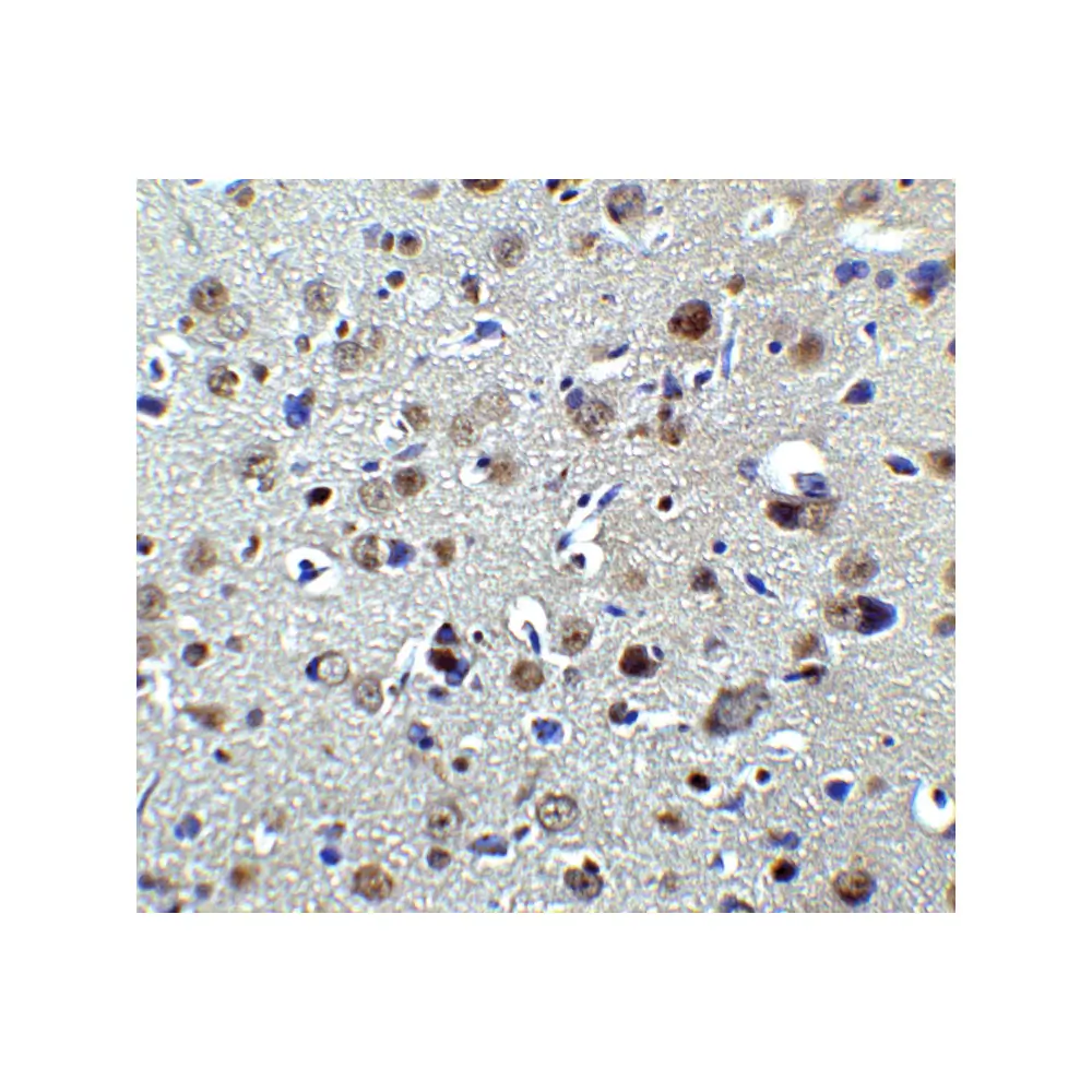 ProSci 7053 PLAGL2 Antibody, ProSci, 0.1 mg/Unit Secondary Image