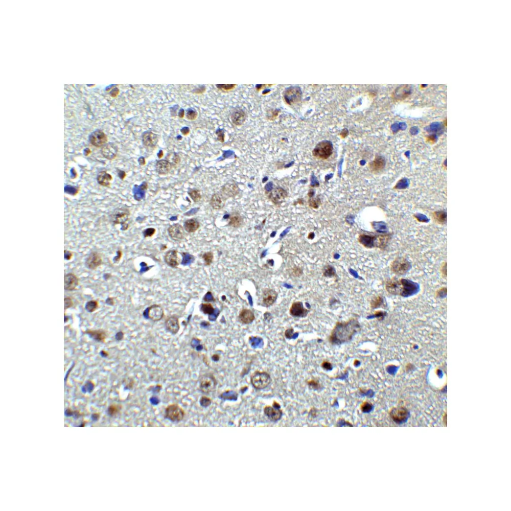 ProSci 7053_S PLAGL2 Antibody, ProSci, 0.02 mg/Unit Secondary Image